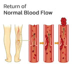 Varicose Veins Patches (10Pcs)