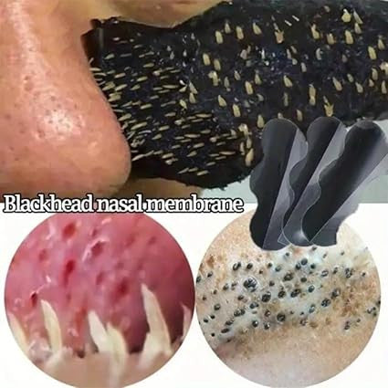 Nose Strips Black Blackhead Remover Pore Strips
