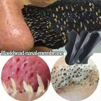 Nose Strips Black Blackhead Remover Pore Strips