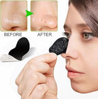 Nose Strips Black Blackhead Remover Pore Strips