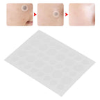 SKIN TAG ACNE PATCH DOTS (108 DOTS )