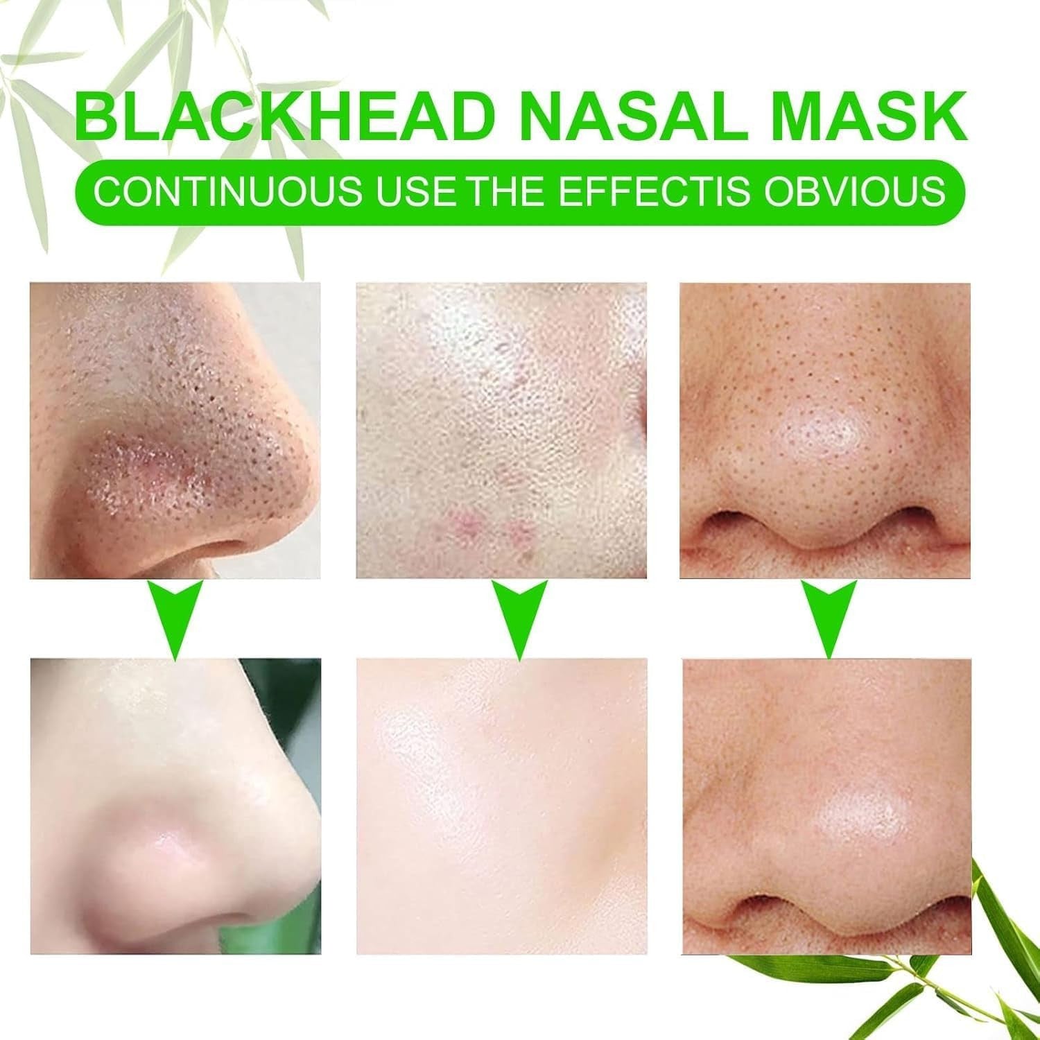 Nose Strips Black Blackhead Remover Pore Strips